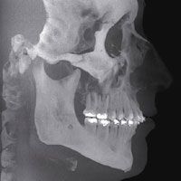 Sch&auml;delaufnahme in 3d